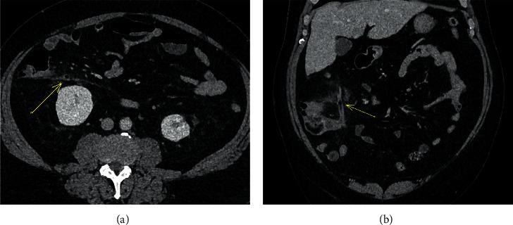https://cdn.ncbi.nlm.nih.gov/pmc/blobs/0538/8629666/1263a98c68f2/RRP2021-7191348.001.jpg