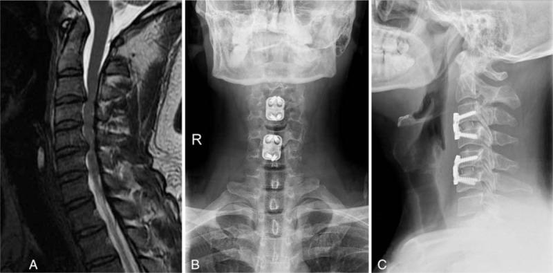 https://cdn.ncbi.nlm.nih.gov/pmc/blobs/053b/5805455/ffeb530173c3/medi-97-e9808-g002.jpg