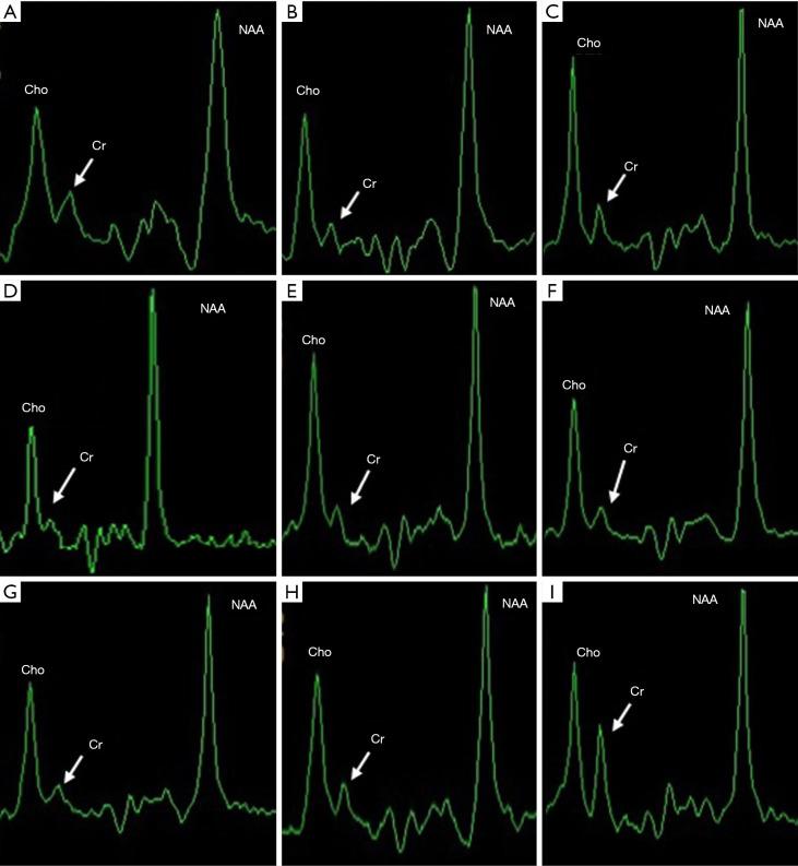 https://cdn.ncbi.nlm.nih.gov/pmc/blobs/053c/10248938/634f34c6effe/tp-12-05-927-f1.jpg