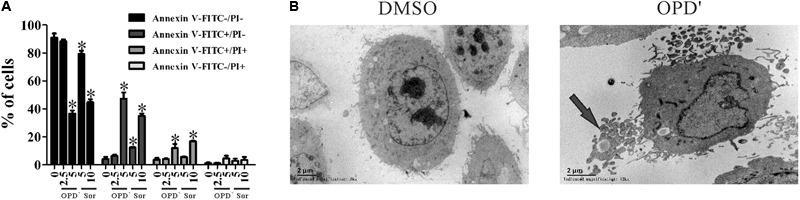 https://cdn.ncbi.nlm.nih.gov/pmc/blobs/053e/5936779/b98eeaa1effa/fphar-09-00432-g002.jpg