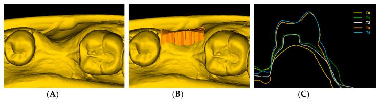 https://cdn.ncbi.nlm.nih.gov/pmc/blobs/0546/7290720/c304b88ed06e/jcm-09-01568-g003.jpg