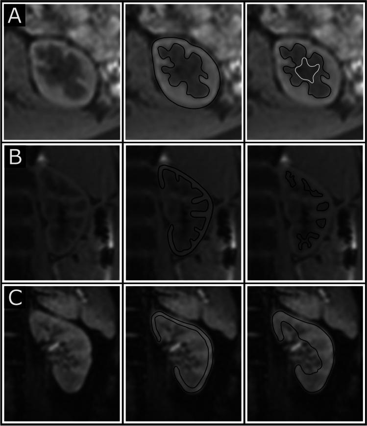 https://cdn.ncbi.nlm.nih.gov/pmc/blobs/0553/10154253/4f96bc1b24c8/467_2022_5785_Fig1_HTML.jpg