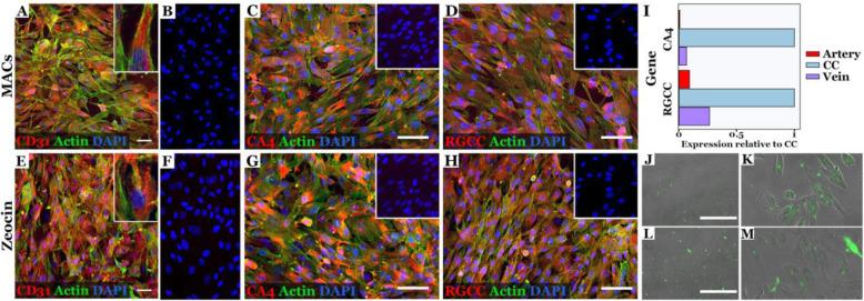 https://cdn.ncbi.nlm.nih.gov/pmc/blobs/0559/7510078/37a8c3d8cb28/13287_2020_1903_Fig4_HTML.jpg