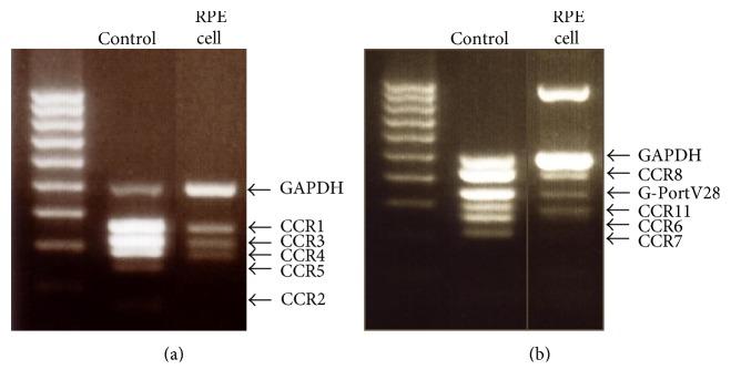 https://cdn.ncbi.nlm.nih.gov/pmc/blobs/056e/5511656/d60ab985395f/MI2017-3124753.002.jpg