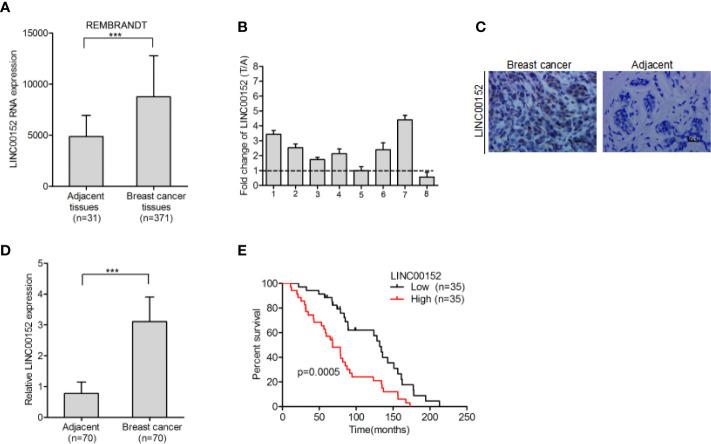 https://cdn.ncbi.nlm.nih.gov/pmc/blobs/056f/8032978/6f0333b375db/fonc-11-619915-g001.jpg