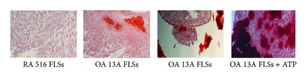 https://cdn.ncbi.nlm.nih.gov/pmc/blobs/0574/4054973/693c3e437849/ARTHRITIS2014-812678.006.jpg