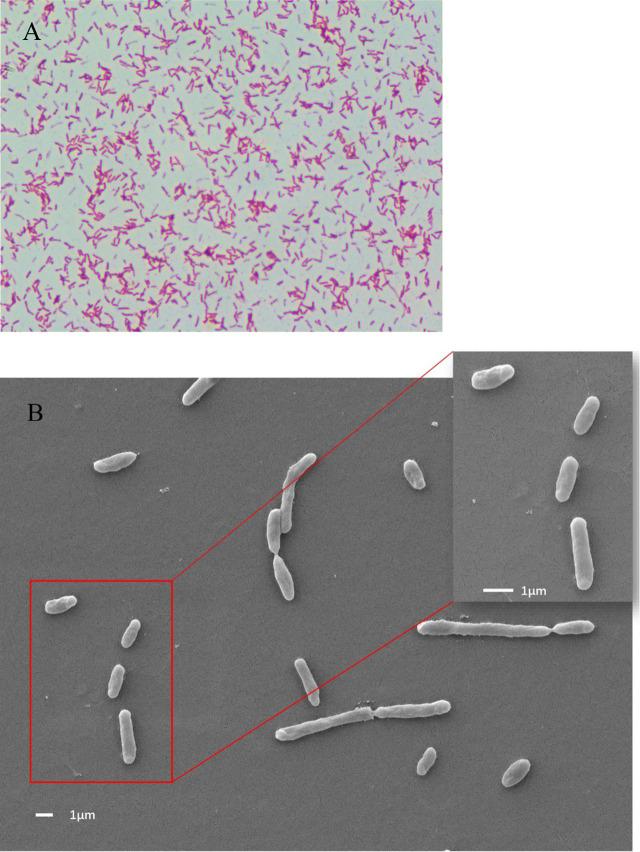 https://cdn.ncbi.nlm.nih.gov/pmc/blobs/0574/9618692/0ec262cbc0a9/fcimb-12-1042977-g002.jpg