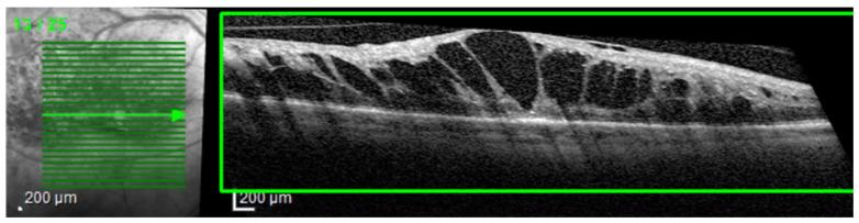 https://cdn.ncbi.nlm.nih.gov/pmc/blobs/057b/10795694/3f1dcaa78f17/diagnostics-14-00076-g002.jpg