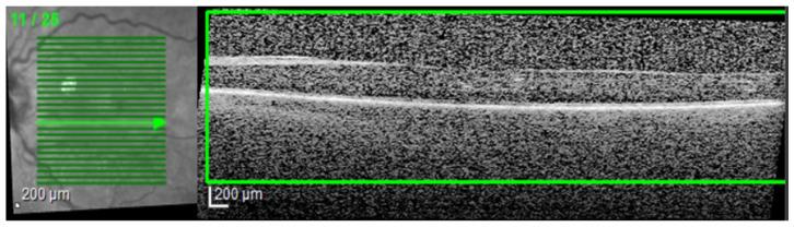 https://cdn.ncbi.nlm.nih.gov/pmc/blobs/057b/10795694/adcd1017435d/diagnostics-14-00076-g003.jpg