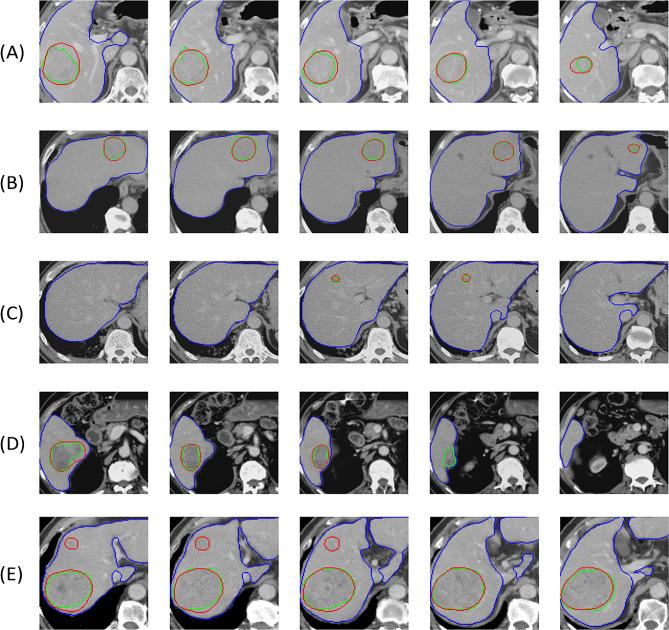 https://cdn.ncbi.nlm.nih.gov/pmc/blobs/057d/10964581/abf1d7708a0e/40644_2024_686_Fig3_HTML.jpg