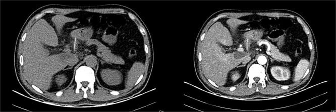 https://cdn.ncbi.nlm.nih.gov/pmc/blobs/057d/11651079/5a7ee99cdccd/rjae787f1.jpg