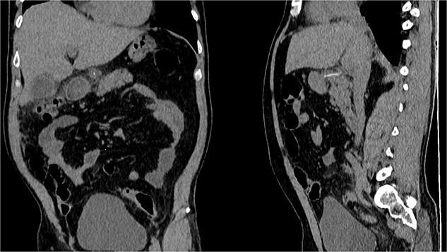 https://cdn.ncbi.nlm.nih.gov/pmc/blobs/057d/11651079/f197b638ad03/rjae787f2.jpg