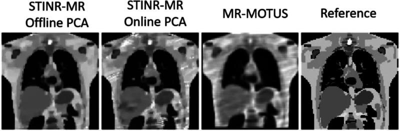 https://cdn.ncbi.nlm.nih.gov/pmc/blobs/057e/10462175/7b235dec6fda/nihpp-2308.09771v1-f0007.jpg