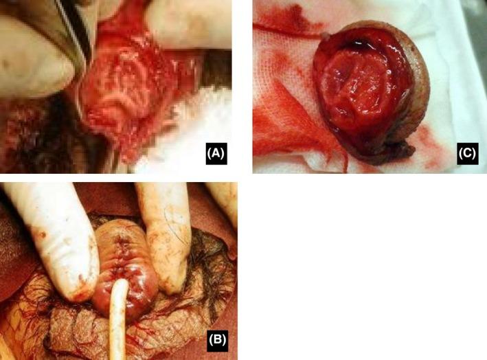 https://cdn.ncbi.nlm.nih.gov/pmc/blobs/0585/5667300/c523f2fa3ed3/AMS2-4-101-g002.jpg