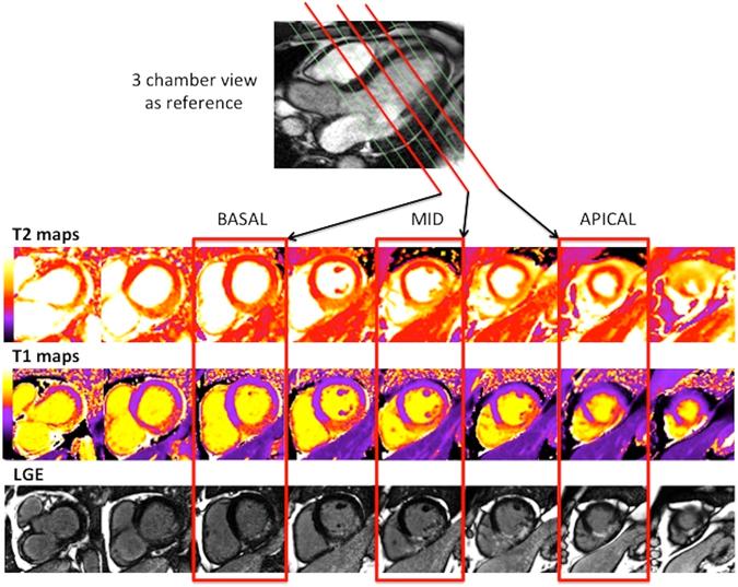 https://cdn.ncbi.nlm.nih.gov/pmc/blobs/058d/5501789/b612e3e98b0a/41598_2017_5127_Fig6_HTML.jpg