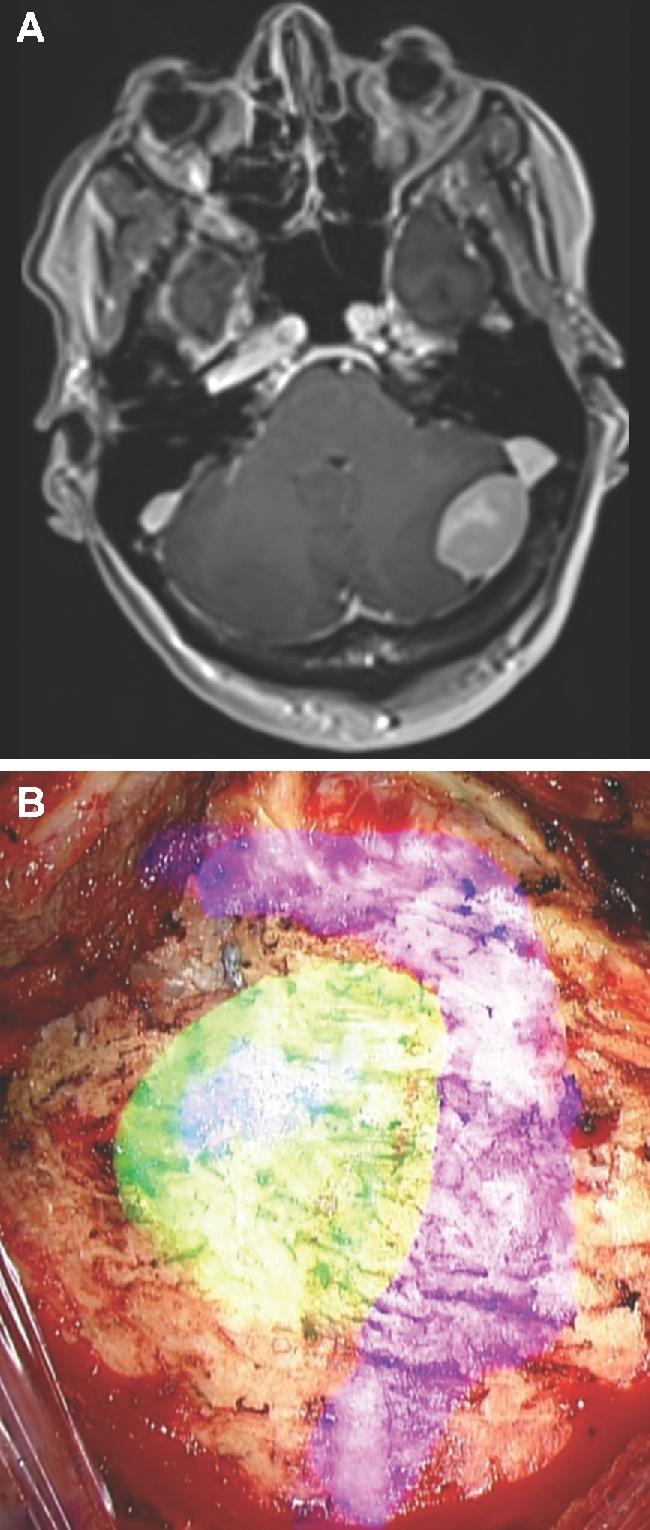 https://cdn.ncbi.nlm.nih.gov/pmc/blobs/058d/6047456/2930aa66d9a3/opx205fig5.jpg
