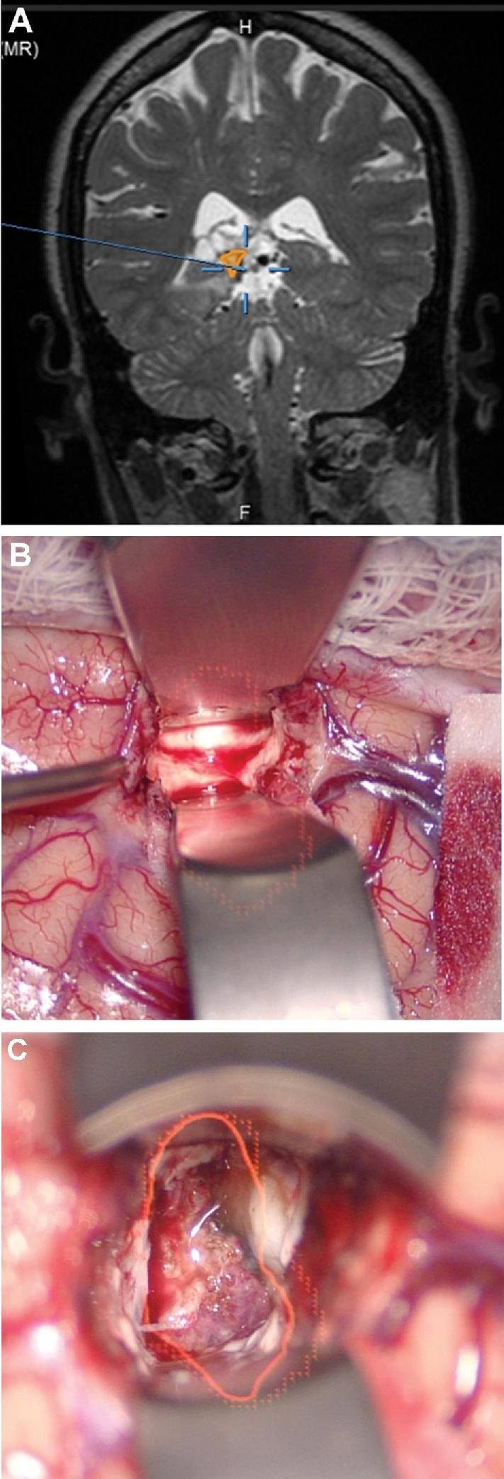 https://cdn.ncbi.nlm.nih.gov/pmc/blobs/058d/6047456/324e271a7fae/opx205fig9.jpg
