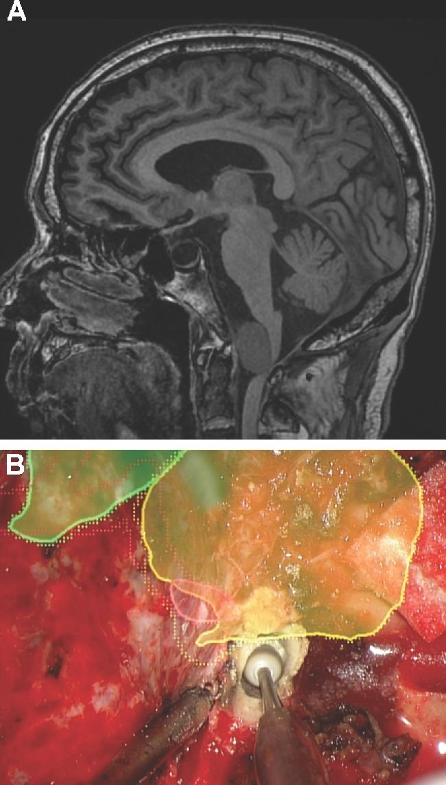 https://cdn.ncbi.nlm.nih.gov/pmc/blobs/058d/6047456/4f0a3de4e54a/opx205fig6.jpg
