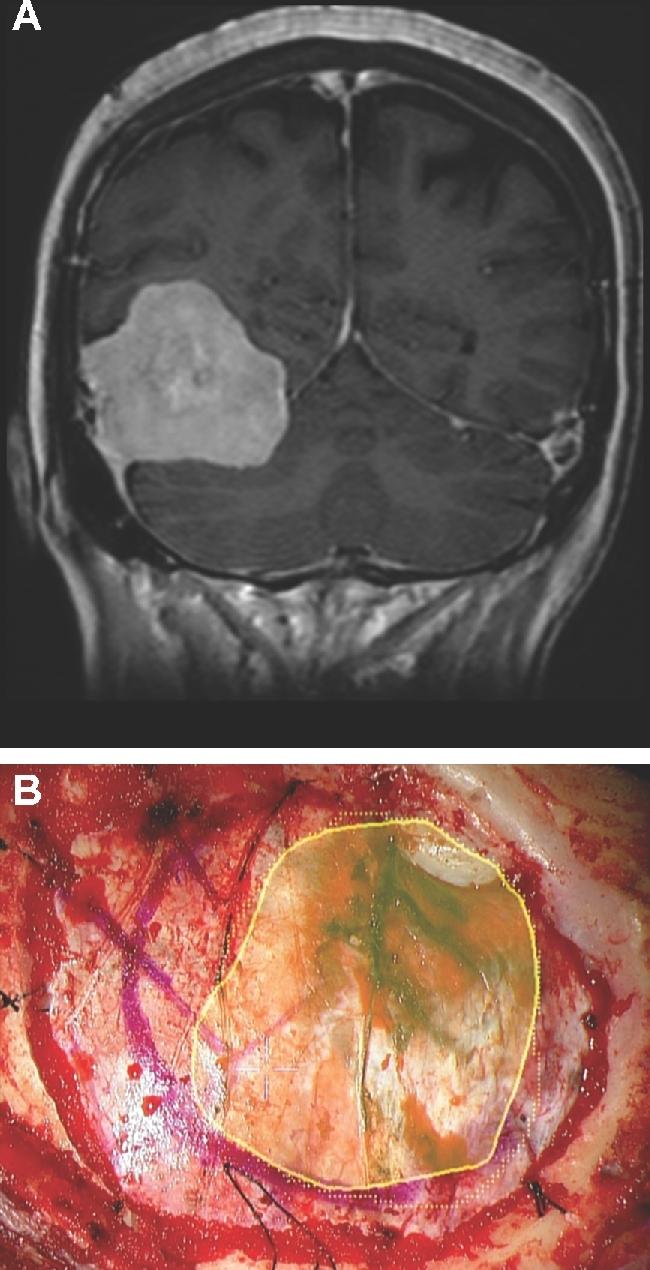 https://cdn.ncbi.nlm.nih.gov/pmc/blobs/058d/6047456/59ebdb712bbe/opx205fig7.jpg