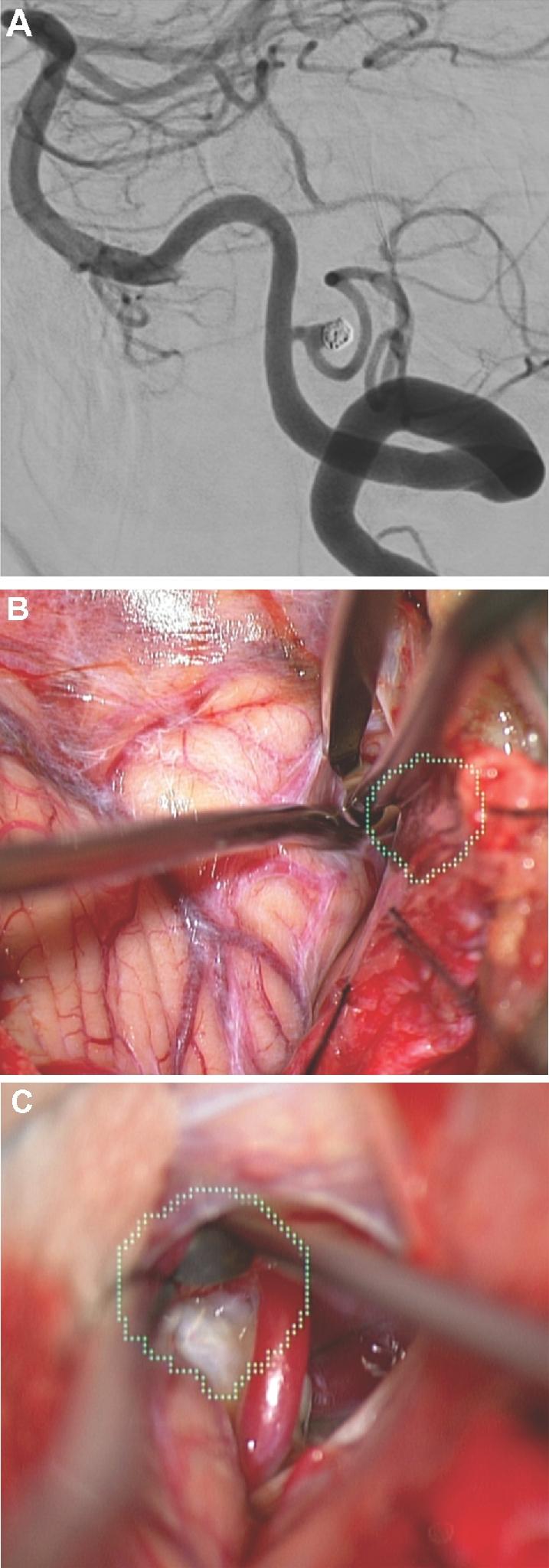 https://cdn.ncbi.nlm.nih.gov/pmc/blobs/058d/6047456/88e15917a2e3/opx205fig8.jpg