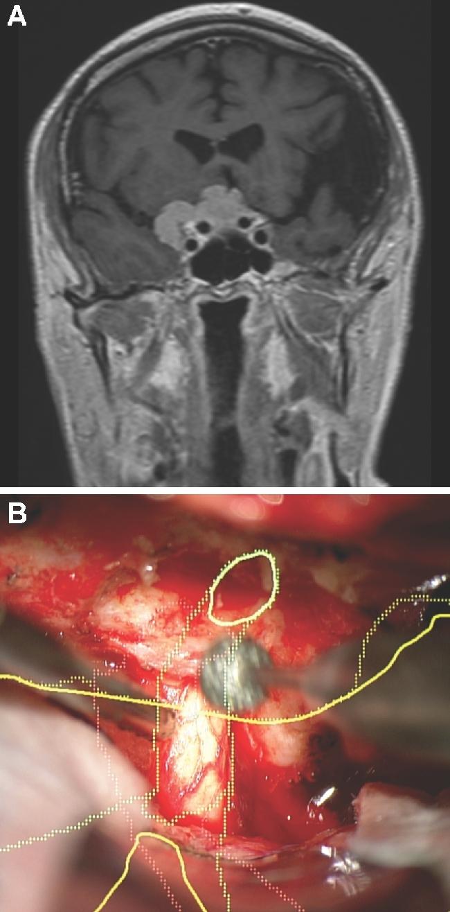https://cdn.ncbi.nlm.nih.gov/pmc/blobs/058d/6047456/955fd016c744/opx205fig10.jpg