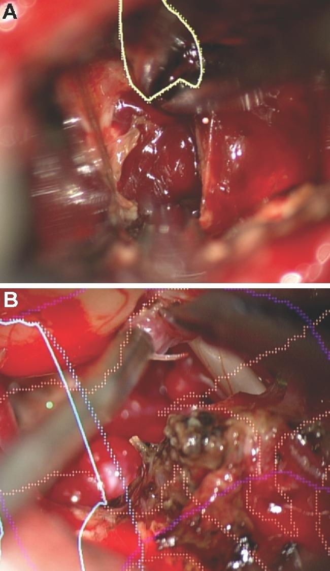https://cdn.ncbi.nlm.nih.gov/pmc/blobs/058d/6047456/9bbcd312ab47/opx205fig13.jpg