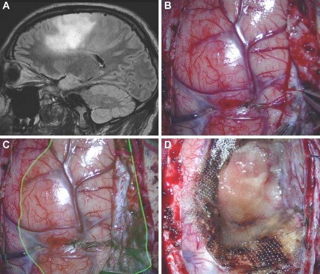 https://cdn.ncbi.nlm.nih.gov/pmc/blobs/058d/6047456/cb9d571051a4/opx205fig12.jpg