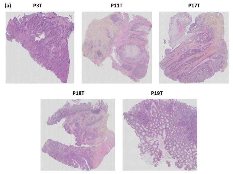 https://cdn.ncbi.nlm.nih.gov/pmc/blobs/0590/8000445/3213a85a11e6/biomedicines-09-00282-g012a.jpg