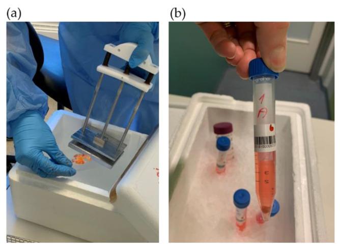 https://cdn.ncbi.nlm.nih.gov/pmc/blobs/0590/8000445/fe6e7932cb5e/biomedicines-09-00282-g002.jpg