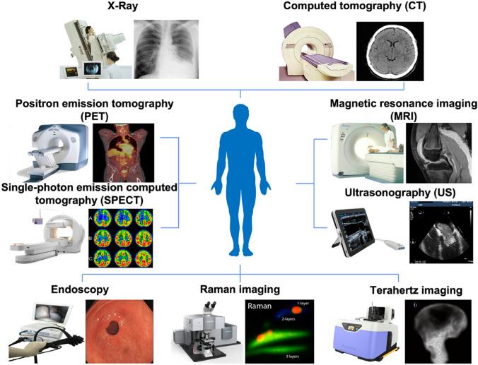 https://cdn.ncbi.nlm.nih.gov/pmc/blobs/0591/10781914/9c2d6cc83aa6/43657_2023_128_Fig2_HTML.jpg