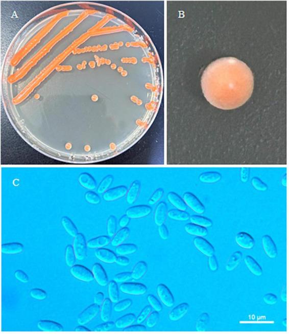 https://cdn.ncbi.nlm.nih.gov/pmc/blobs/0594/10876860/8ac565f8003c/fmicb-15-1287984-g003.jpg