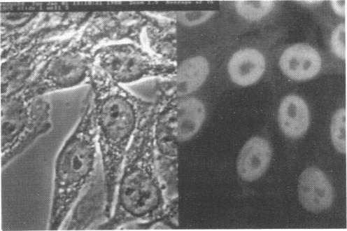 https://cdn.ncbi.nlm.nih.gov/pmc/blobs/0595/1534802/739ca6f53643/clinexpimmunol00027-0156-d.jpg