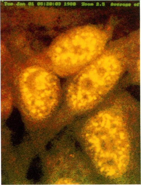 https://cdn.ncbi.nlm.nih.gov/pmc/blobs/0595/1534802/cd2179a0f960/clinexpimmunol00027-0156-b.jpg