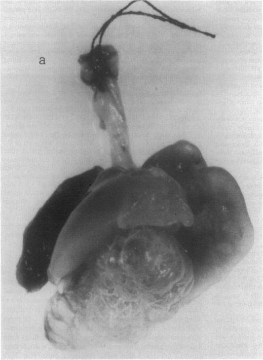 https://cdn.ncbi.nlm.nih.gov/pmc/blobs/0597/442778/066a4b8a5d06/jcinvest00103-0172-a.jpg