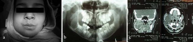 https://cdn.ncbi.nlm.nih.gov/pmc/blobs/0599/3177391/073a0de323a0/DRJ-8-150-g001.jpg