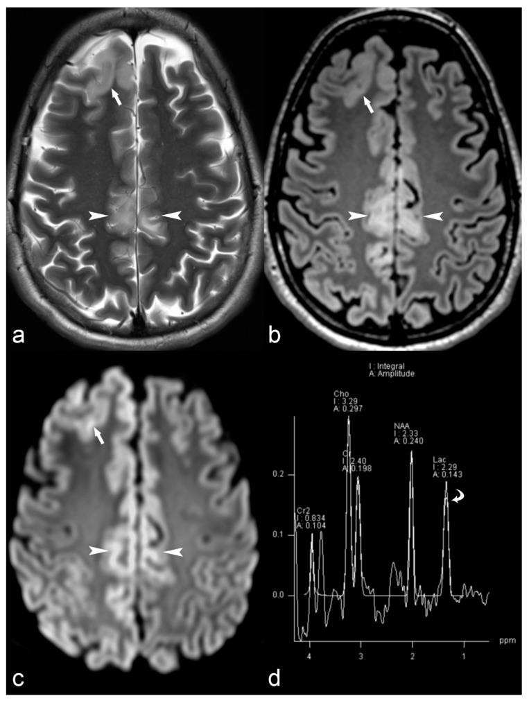 https://cdn.ncbi.nlm.nih.gov/pmc/blobs/059f/6462967/3e0db8a77373/children-06-00043-g001.jpg