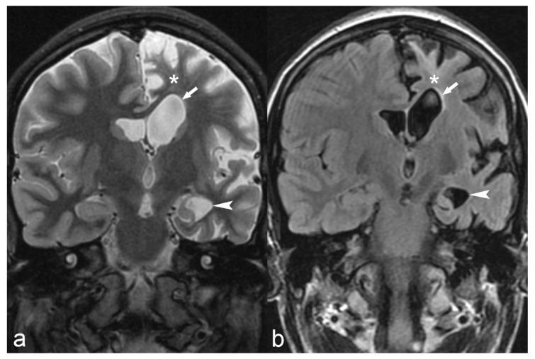 https://cdn.ncbi.nlm.nih.gov/pmc/blobs/059f/6462967/623dd778d87d/children-06-00043-g012.jpg