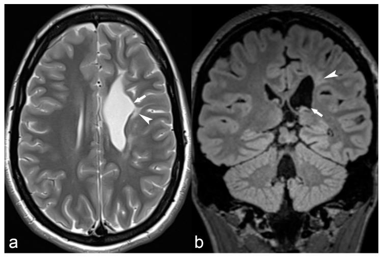 https://cdn.ncbi.nlm.nih.gov/pmc/blobs/059f/6462967/bac6acb5391d/children-06-00043-g010.jpg