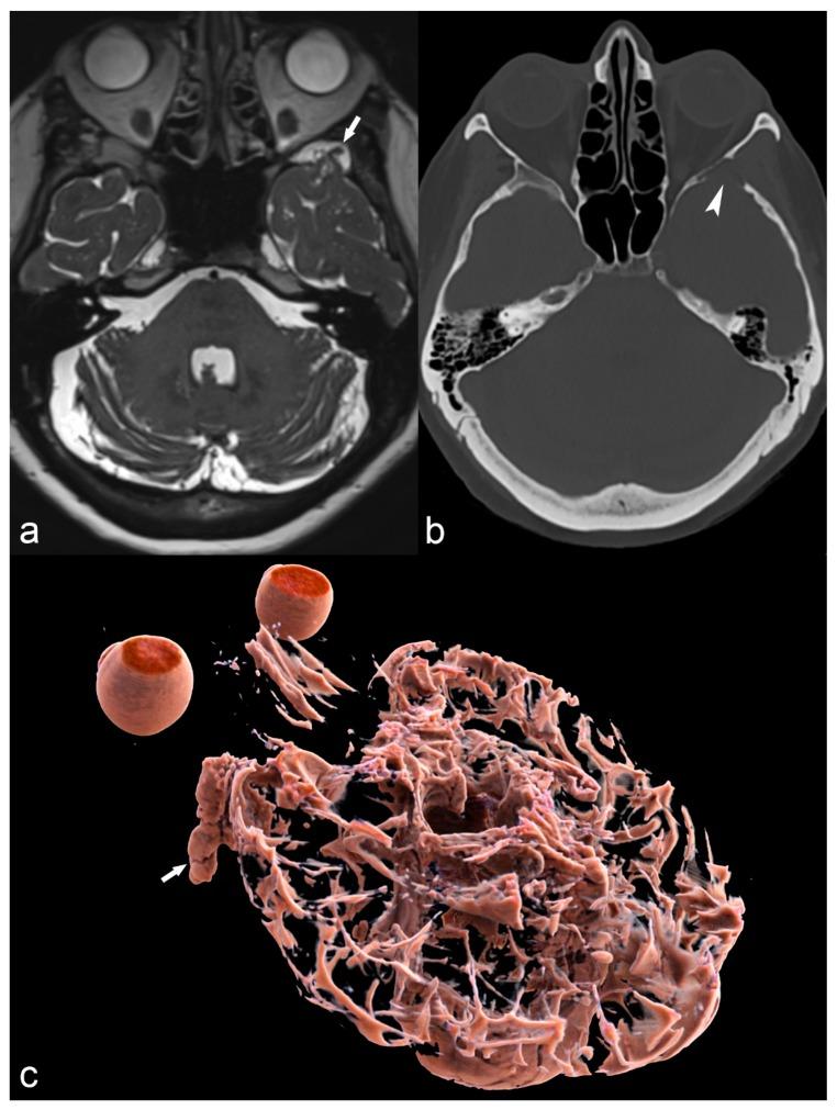 https://cdn.ncbi.nlm.nih.gov/pmc/blobs/059f/6462967/c6e7e96bd9ea/children-06-00043-g014.jpg