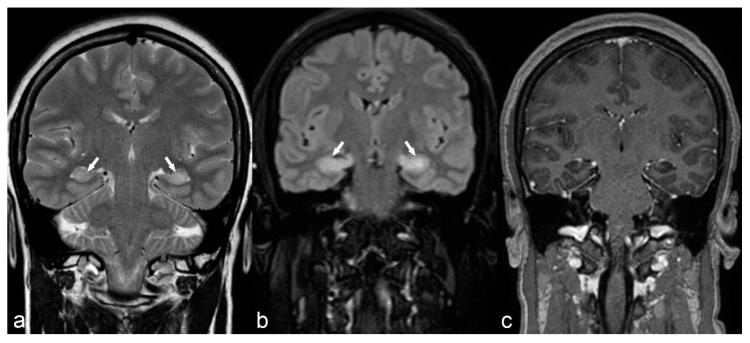 https://cdn.ncbi.nlm.nih.gov/pmc/blobs/059f/6462967/e66d9c28f5ca/children-06-00043-g013.jpg