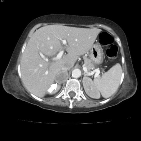 https://cdn.ncbi.nlm.nih.gov/pmc/blobs/059f/9590816/42e884850040/1853-0605-79-3-301-g003.jpg