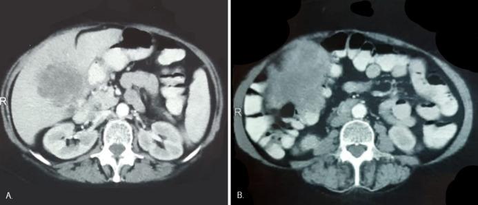 https://cdn.ncbi.nlm.nih.gov/pmc/blobs/059f/9590816/48763995ed39/1853-0605-79-3-301-g001.jpg