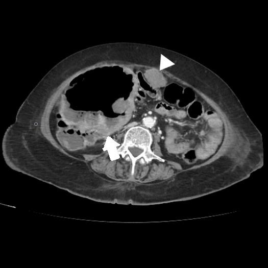 https://cdn.ncbi.nlm.nih.gov/pmc/blobs/059f/9590816/98a83521d710/1853-0605-79-3-301-g004.jpg