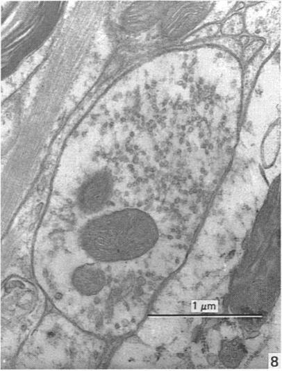 https://cdn.ncbi.nlm.nih.gov/pmc/blobs/05a4/1262005/1d4e06d862ed/janat00173-0033-b.jpg