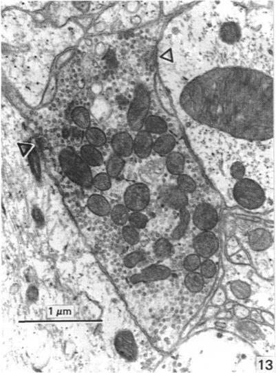https://cdn.ncbi.nlm.nih.gov/pmc/blobs/05a4/1262005/4bcb6319cf0b/janat00173-0034-c.jpg