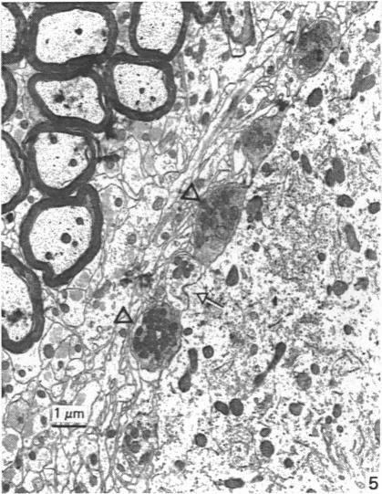 https://cdn.ncbi.nlm.nih.gov/pmc/blobs/05a4/1262005/c515c706b746/janat00173-0032-b.jpg