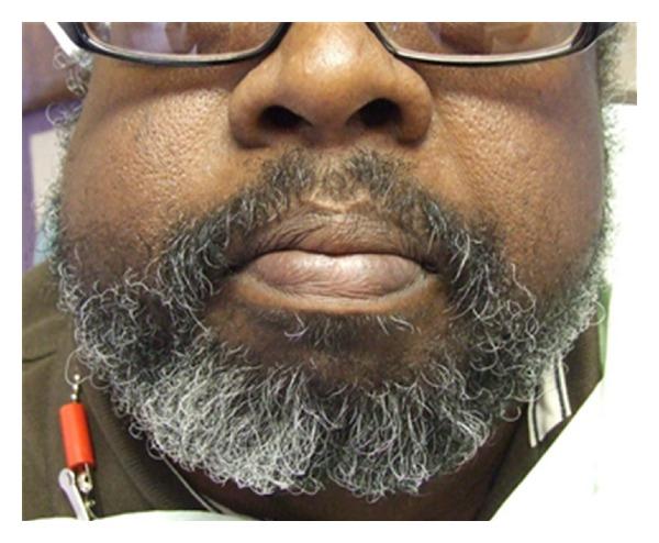 https://cdn.ncbi.nlm.nih.gov/pmc/blobs/05aa/3350159/f18900d5c64b/CRIM.RADIOLOGY2011-415476.001.jpg