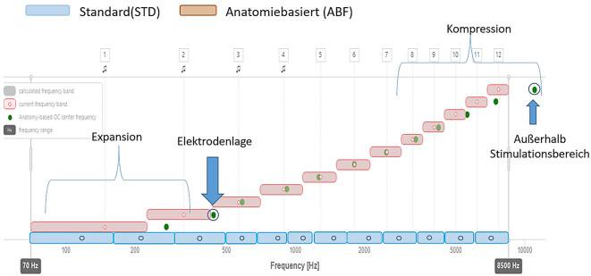 https://cdn.ncbi.nlm.nih.gov/pmc/blobs/05ae/12021728/1ac10093aa4c/106_2025_1593_Fig4_HTML.jpg