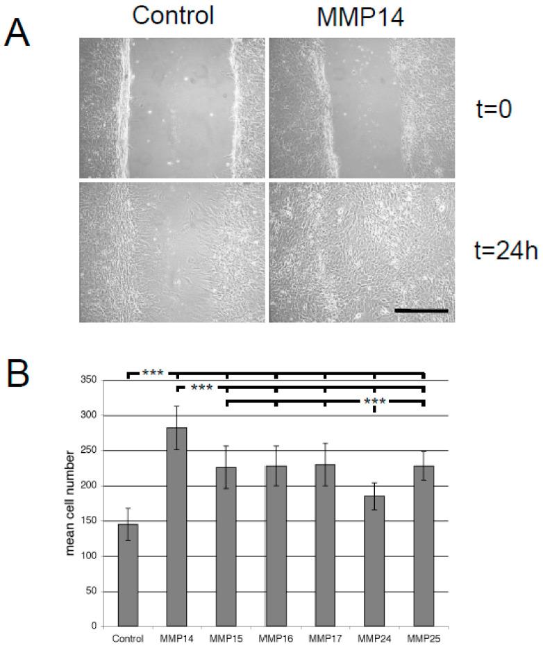 https://cdn.ncbi.nlm.nih.gov/pmc/blobs/05b1/7565296/6cc2313eca30/cancers-12-02456-g004.jpg