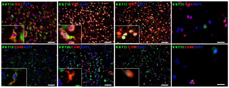 https://cdn.ncbi.nlm.nih.gov/pmc/blobs/05b1/7565296/a597383d2d82/cancers-12-02456-g002.jpg